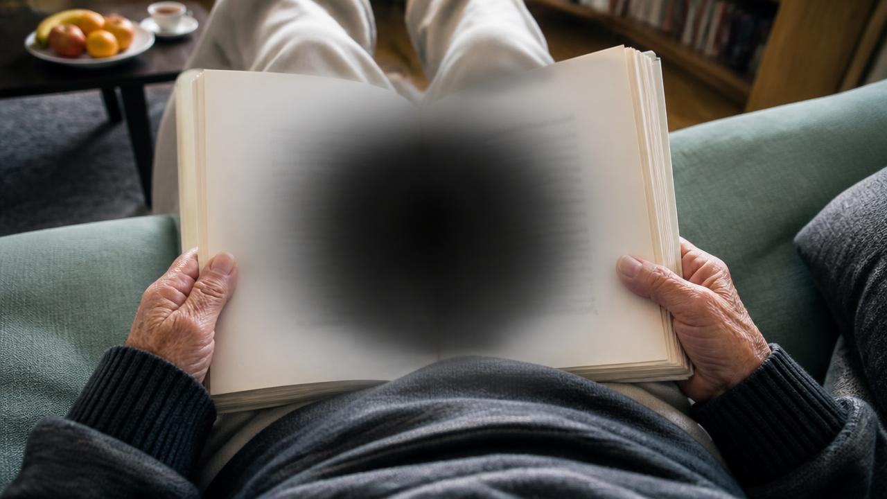 Ilustração de degeneração macular relacionada à idade (DMRI)